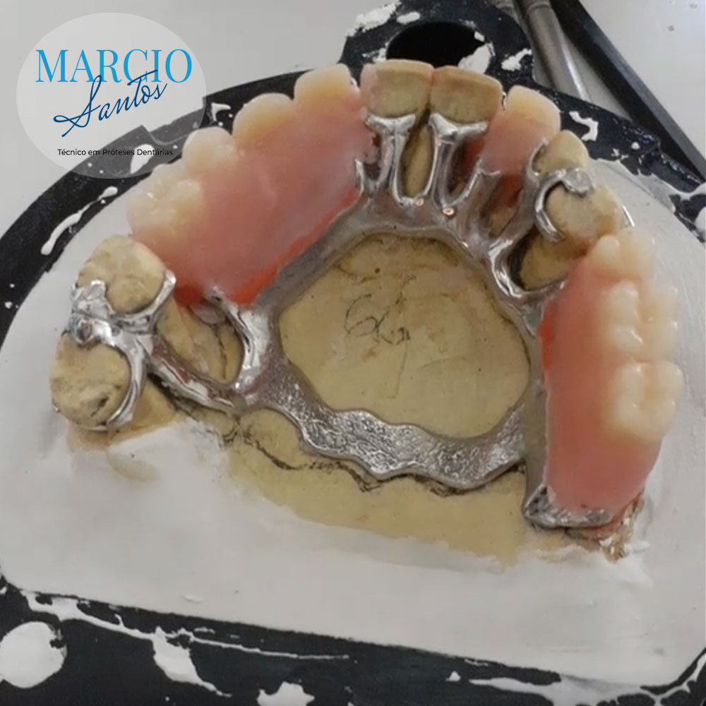 Inclusão de uma PPR